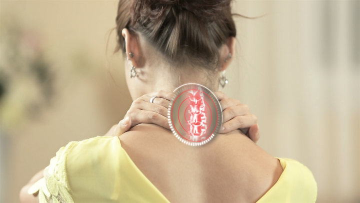 4 dấu hiệu của bệnh thoái hóa đốt sống cổ: Nên chăm sóc sớm để không bị nặng lên