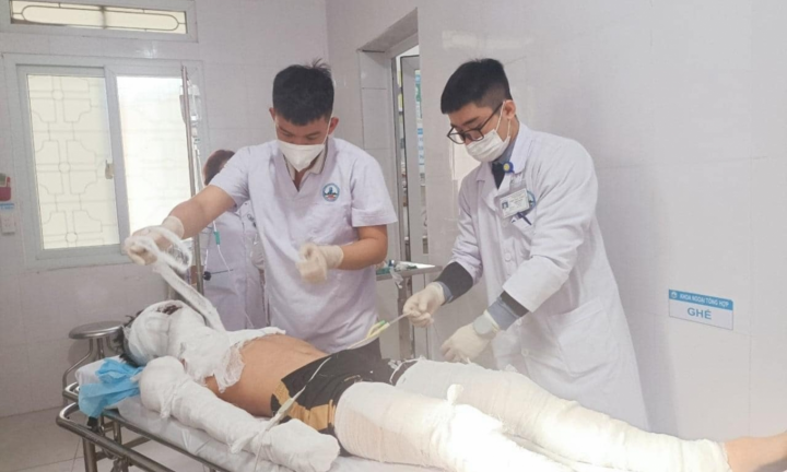Nam sinh bỏng nặng nghi do đốt pháo hoa
