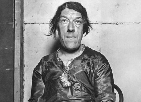 Cuộc đời bi thảm của 'người phụ nữ xấu nhất thế giới'