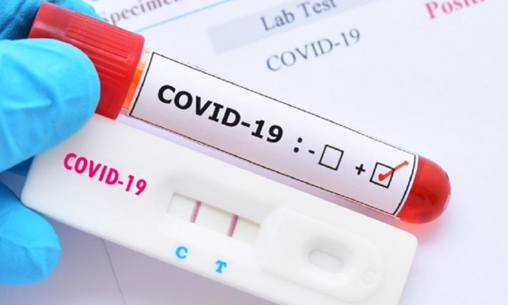 Xét nghiệm PCR COVID-19: Chỉ số Ct càng cao càng khó lây nhiễm