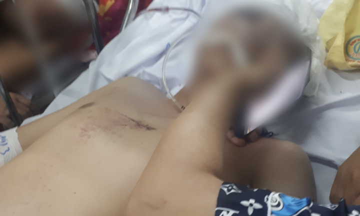 Bị tố truy đuổi, bỏ mặc người vi phạm bị tai nạn: Công an huyện ở Cà Mau nói gì?