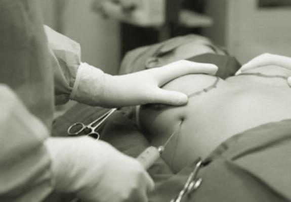 Những biến chứng có thể gặp khi phẫu thuật nâng ngực