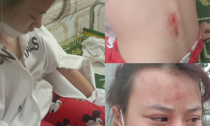 Nữ sinh lớp 10 ở Hà Tĩnh bị hàng xóm đánh chấn động não