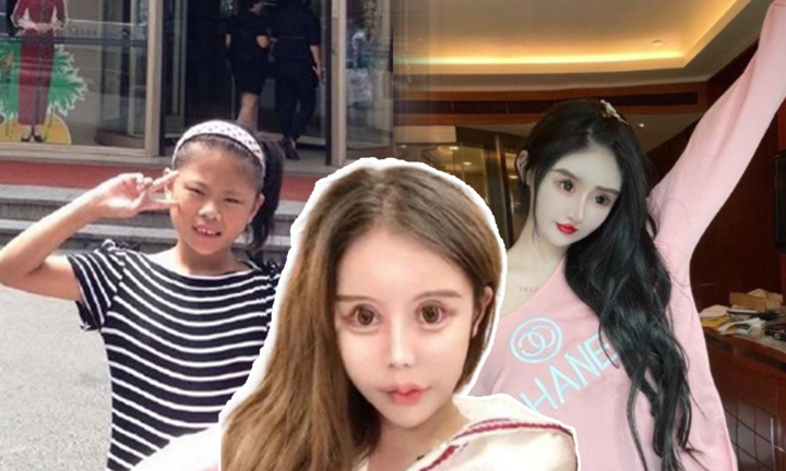 Bi kịch cô bé 13 tuổi phẫu thuật thẩm mỹ, hơn 100 lần dao kéo để được đối xử tốt