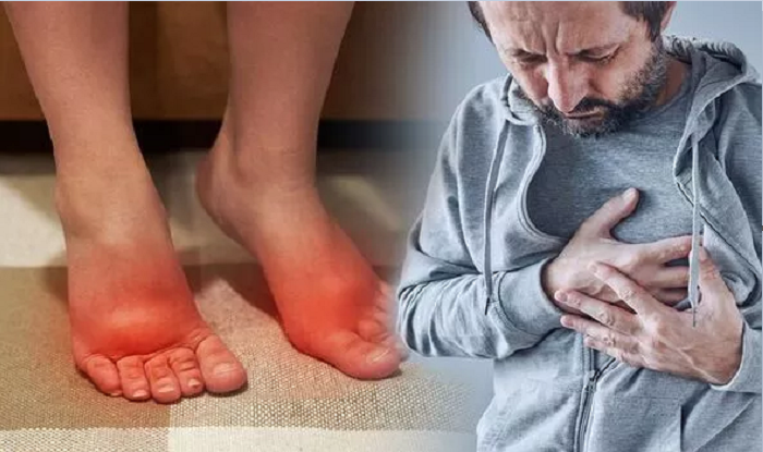 Dấu hiệu lạ ở chân cảnh báo nguy cơ cơn đau tim hoặc đột quỵ có thể sắp xảy ra