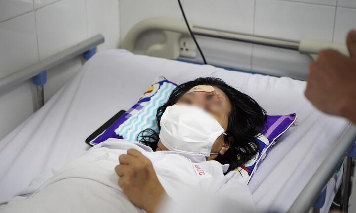 Mù mắt sau khi tiêm filler nâng mũi ở spa