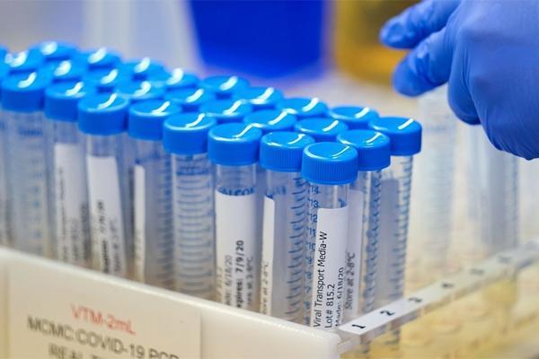 Điều gì xảy ra khi COVID-19 trở thành bệnh đặc hữu?