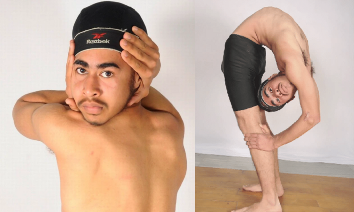 Luffy phiên bản đời thực: ‘Cậu bé cao su’ có thể quay đầu 180 độ, bẻ xoắn người