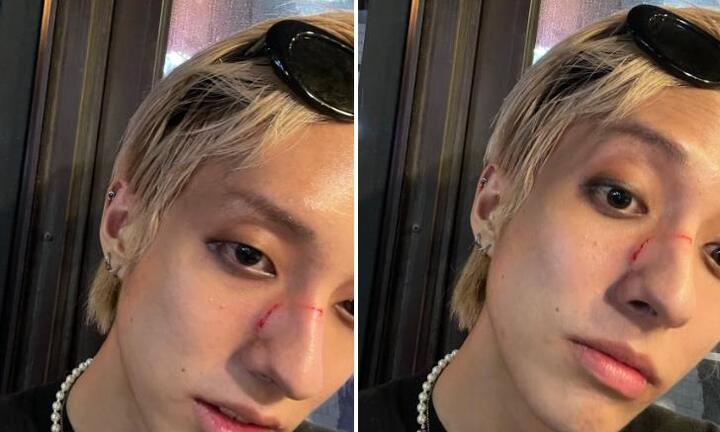 Nam ca sĩ bị đánh trên phố Hàn Quốc chỉ vì là người đồng tính