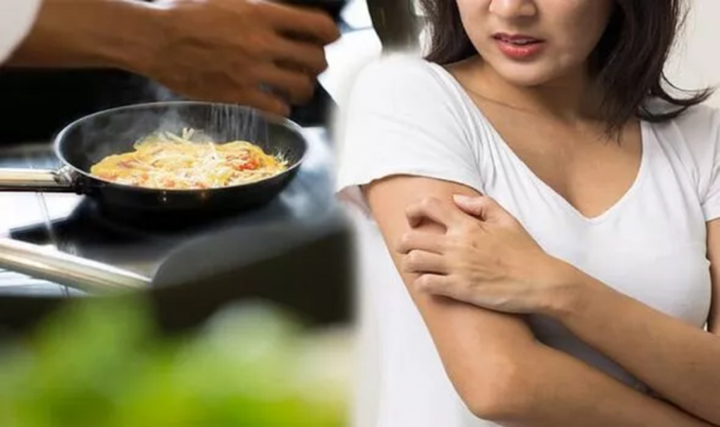 Bị zona thần kinh, nên và không nên ăn gì?