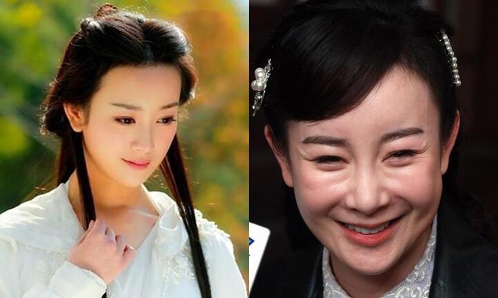 ‘Thần tiên tỷ tỷ’ Cbiz mất cả sự nghiệp vì giật chồng, mặt biến dạng hậu dao kéo