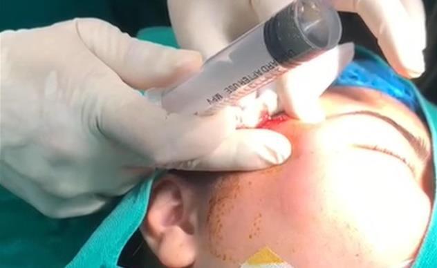 Làm đẹp để đổi 'phong thủy', nhiều ca biến chứng nặng