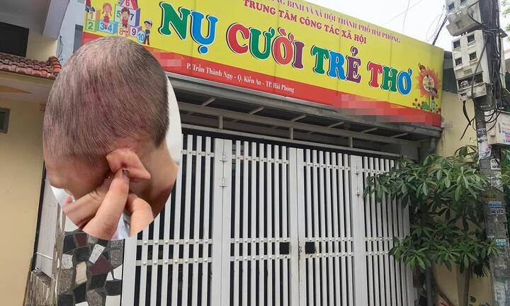 Trẻ 2 tuổi nghi bị bạo hành: Trung tâm giáo dục chuyên biệt tạm dừng hoạt động