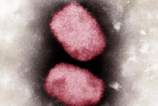 Bỉ giải trình tự gen của virus gây bệnh đậu mùa khỉ