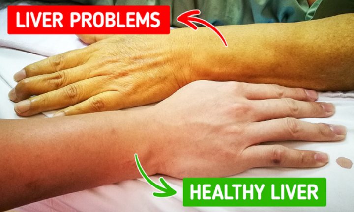 8 dấu hiệu trên cơ thể cảnh báo sức khỏe đang có vấn đề