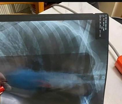 Nữ hành khách bị tài xế xe công nghệ hành hung ở TP.HCM