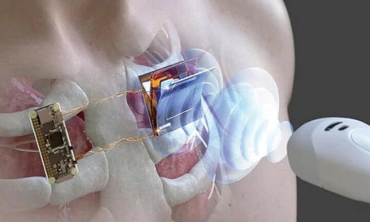 Sạc thiết bị điện tử từ xa bằng sóng siêu âm