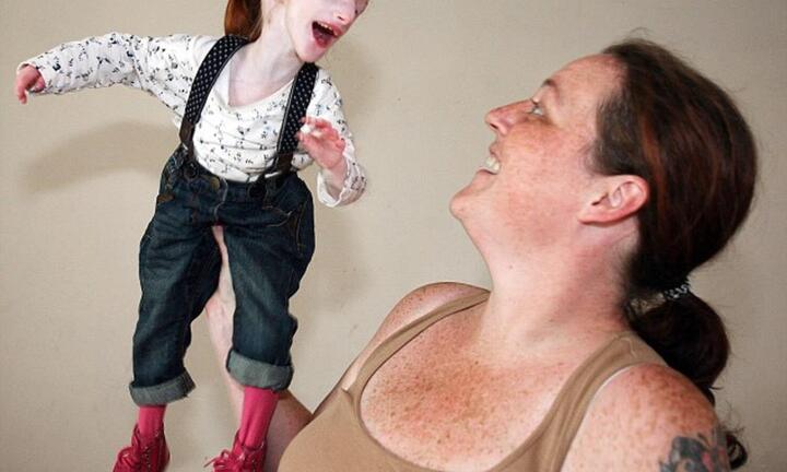 Bé gái nhỏ nhất thế giới kiên cường vượt qua dự đoán ‘không thể sống quá 1 tuổi’