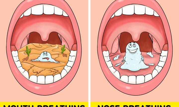 25% người bị hôi miệng mà không biết: 5 lý do và cách khắc phục bạn nên thử ngay