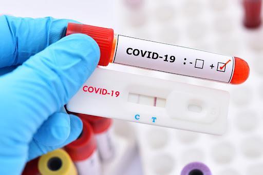 Cả nước thêm 802 ca mắc COVID-19