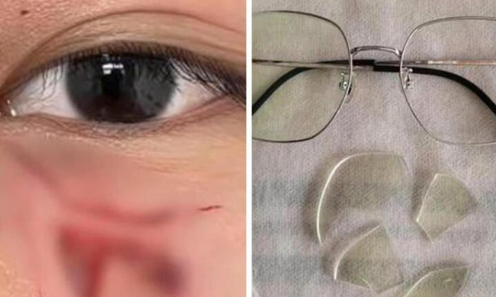 Đấm rách mặt học sinh, giáo viên ở Trung Quốc bị sa thải