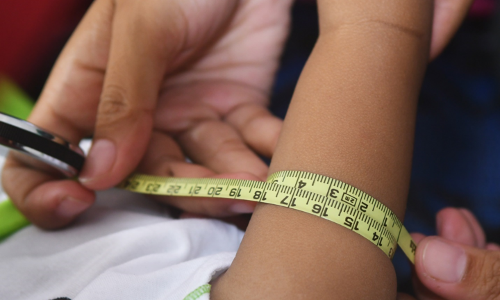 Suy dinh dưỡng vẫn là một thách thức lớn đối với trẻ em Đông Nam Á