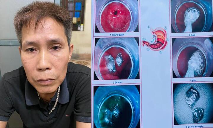 Gặp công an, nuốt luôn ma túy phi tang