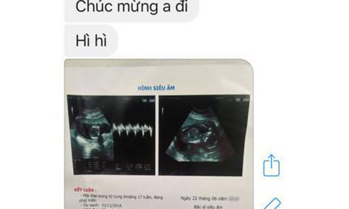 Sững sờ khi bạn trai cũ nhắn tin khoe lên chức bố, cô gái đáp trả 'căng đét'