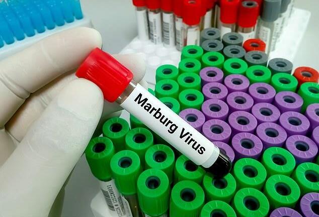 Mức độ nguy hiểm của loại virus chưa có vaccine, tỷ lệ tử vong cao