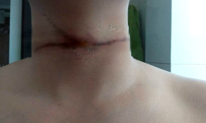 Chàng trai chia sẻ sự cố trời giáng từ dây diều khiến dân mạng rùng mình