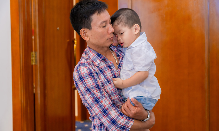 25.000 trẻ bị dị tật khe hở môi - vòm được trả lại nụ cười