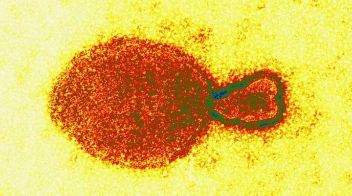 Virus mới phát hiện ở Trung Quốc nguy hiểm thế nào?