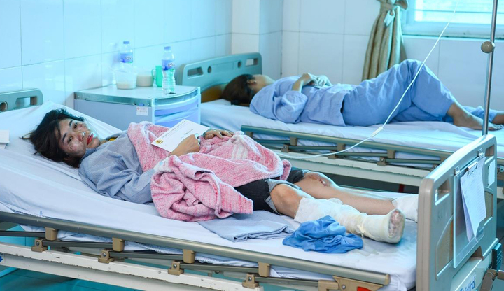 Nổ kinh hoàng khiến 34 người bị thương ở Bắc Ninh: Nạn nhân kể giây phút sinh tử