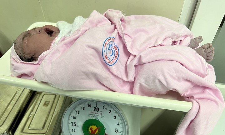 Bé gái ở Bắc Giang sinh mổ, nặng 6,2kg