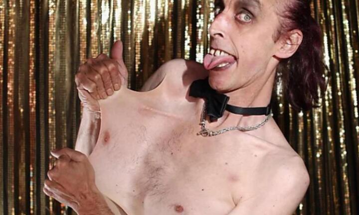 Người đàn ông có ‘làn da cao su’ kéo giãn tùy thích, 20 năm qua chưa có đối thủ