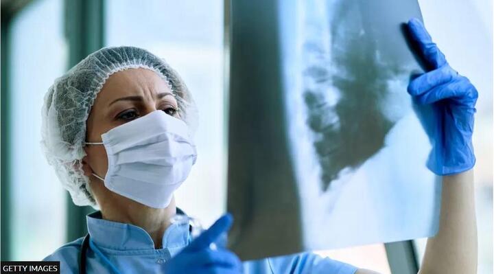 Argentina điều tra ba trường hợp tử vong vì bệnh viêm phổi bí ẩn