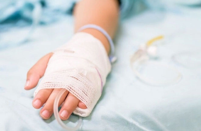 Bé 5 tuổi nhiễm trùng toàn thân do đắp lá chữa bỏng