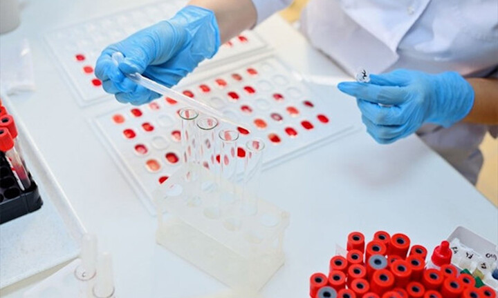 Mối liên hệ giữa nhóm máu và nguy cơ mắc 4 bệnh nguy hiểm