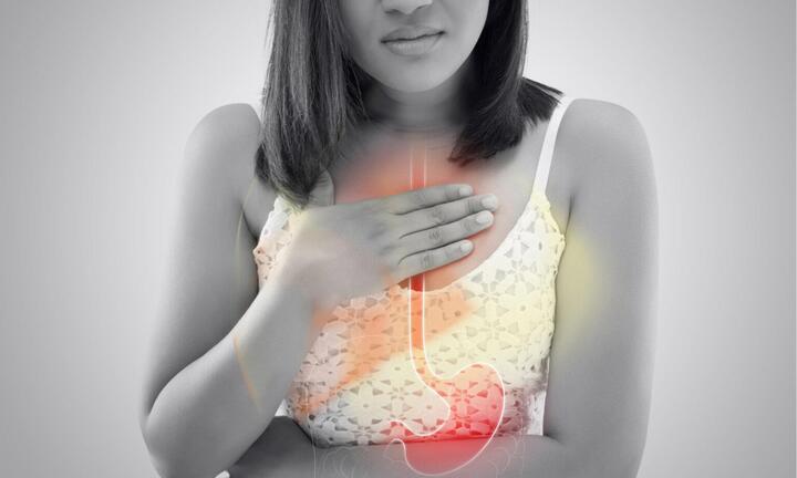 Mua Gastosic ở đâu uy tín, giá hợp lý?