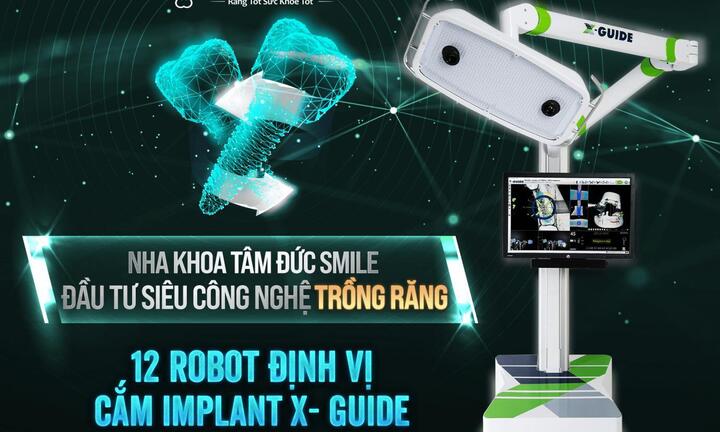 Tâm Đức Smile mở ra kỷ nguyên cấy ghép Implant 4.0 cùng 12 robot định vị X-Guide