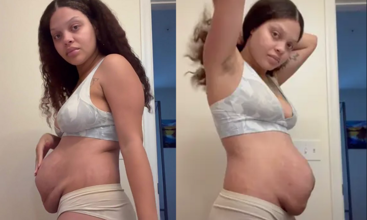Cô gái hút 19 triệu lượt xem khi chia sẻ hình ảnh gây sốc về cơ thể sau sinh