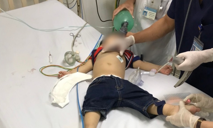 Cứu sống bé trai 22 tháng tuổi ngưng tim, ngưng thở do hóc thạch rau câu