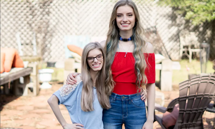 Cặp sinh đôi cùng trứng có 1-0-2 khiến bác sĩ ngỡ ngàng khi làm xét nghiệm