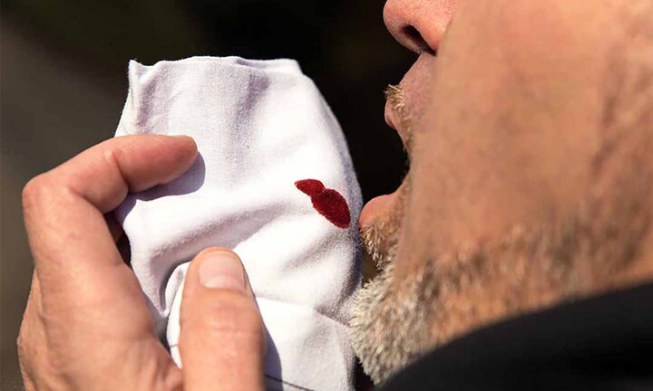 Ho ra máu là biểu hiện của bệnh gì?