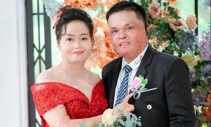 Người phụ nữ từng bị chồng cũ thiêu sống hạnh phúc bên người mới