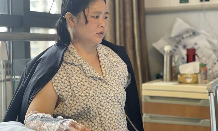 Lao ra cứu bé trai trước đầu xe tải, người phụ nữ bị cắt cụt mất một tay