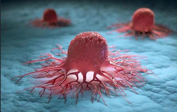 Đột phá: Phát hiện thứ có thể khiến ung thư ngừng di căn