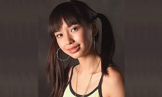 Bị đăng ảnh thời 'vịt con xấu xí', Angelababy kiện bệnh viện nha khoa