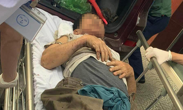 Thùng phuy dầu phát nổ, giám đốc công ty cơ khí bị thương