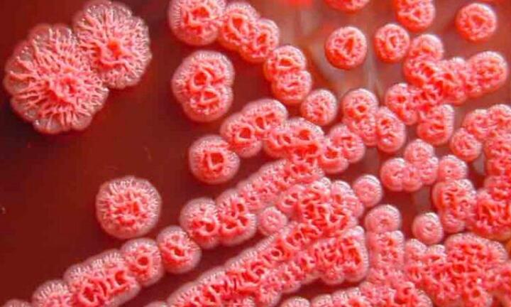 Những biểu hiện lâm sàng thường gặp của bệnh Whitmore 